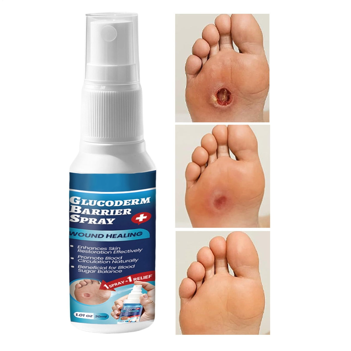 GlucoDerm Barrier Spray For Wound Healing And Skin Restoration | 30ml Rs 229