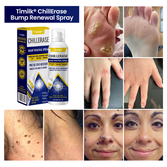 Timilk Chillerase Bump Renewal Spray Skin Spray Reduces Imperfections Refines Texture And Promotes Smooth Radiant Skin - 60ML