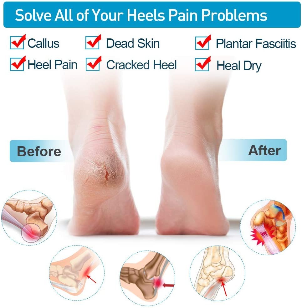 Silicone Heel Protector Sleeve for Cracked Heels & Pain Relief – Breathable & Cushioned Support