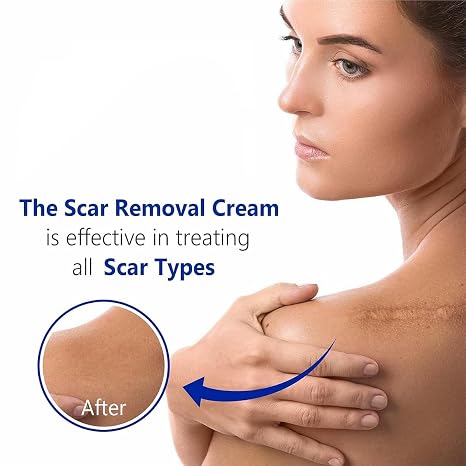 Silicone Scar Removal Gel - Skincare Treatment Designed For Scar Care And Smooth Skin