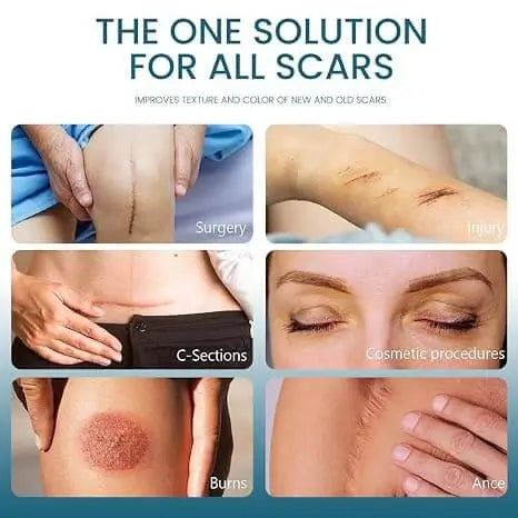 Authentic Silicone Scar Removal Gel – Genuine Product for Scar Care & Smooth Skin
